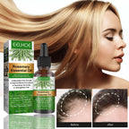Rosemary Anti-Breakage Nourishing Hair Care Oil Lootquake LLC