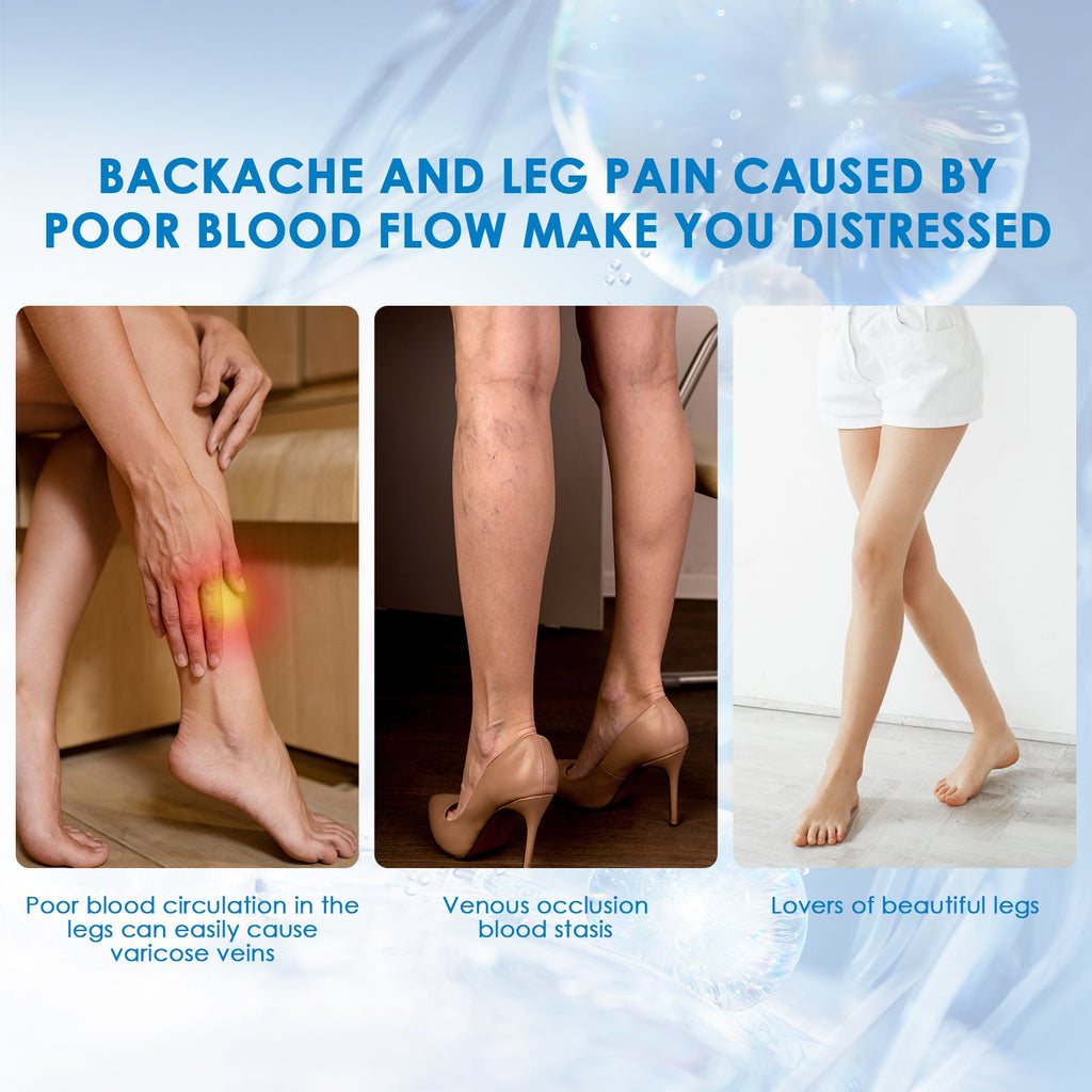 30ml Varicose Vein Spray Multi-Purpose Knee And Leg Care Spray Promote Blood Circulation Lootquake LLC