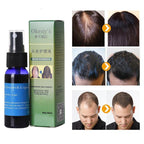 Sunburst Hair Growth Products for women&men anti hair loss products Alopecia Baldness beard oil growth Hair growth spray Lootquake LLC