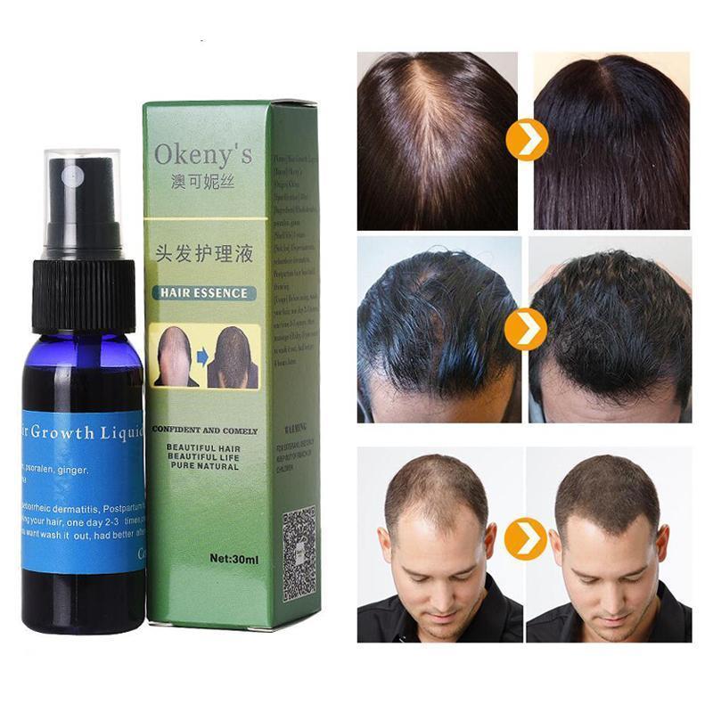 Sunburst Hair Growth Products for women&men anti hair loss products Alopecia Baldness beard oil growth Hair growth spray Lootquake LLC