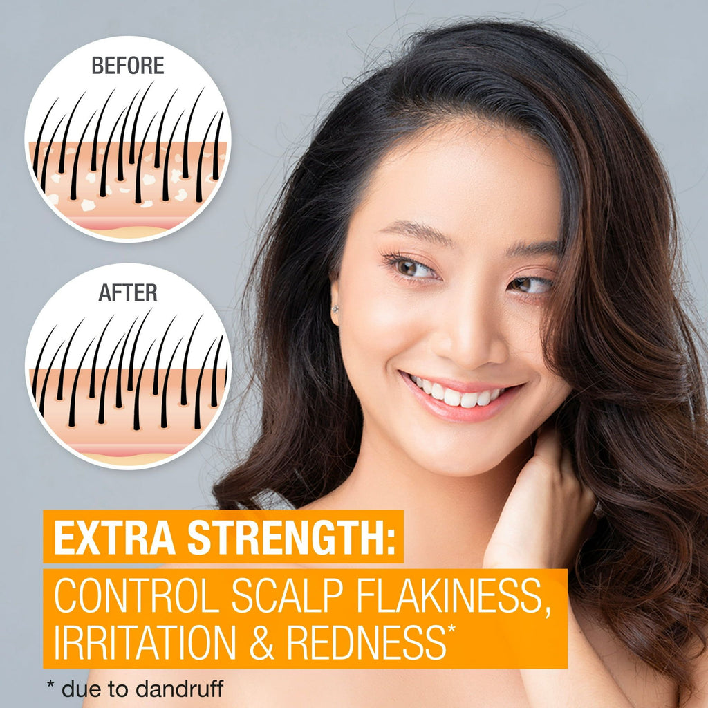 Neutrogena Scalp Therapy Anti-Dandruff Extra Strength EasyOptionXY LLC