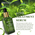 BREYLEE Acne Treatment Serum Face Facial Anti Acne Scar Removal Cream Skin Care Whitening Repair Pimple Remover For Acne Lootquake LLC