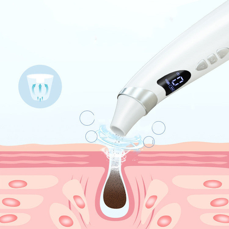 Electric Visual Blackhead Suction Instrument Household Cleansing Pore Cleaner For Skin Equipment Skin Care Tool Pi-Mart