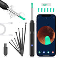 KEKOY Ear Cleaner with Camera, Earwax Remover Tool, 1296P HD Ear Otoscope with 6 LED Lights, 6 Ear Spoon & 8 Tools Ear Wax Removal Kit for iPhone, iPad & Android Smart Phone