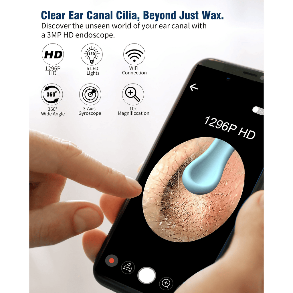 KEKOY Ear Wax Removal, Ear Cleaner, Otoscope with 1269P, Ear Camera with Light, Ear Cleaning Kit for iPhone, iPad, Android Phones, Gold
