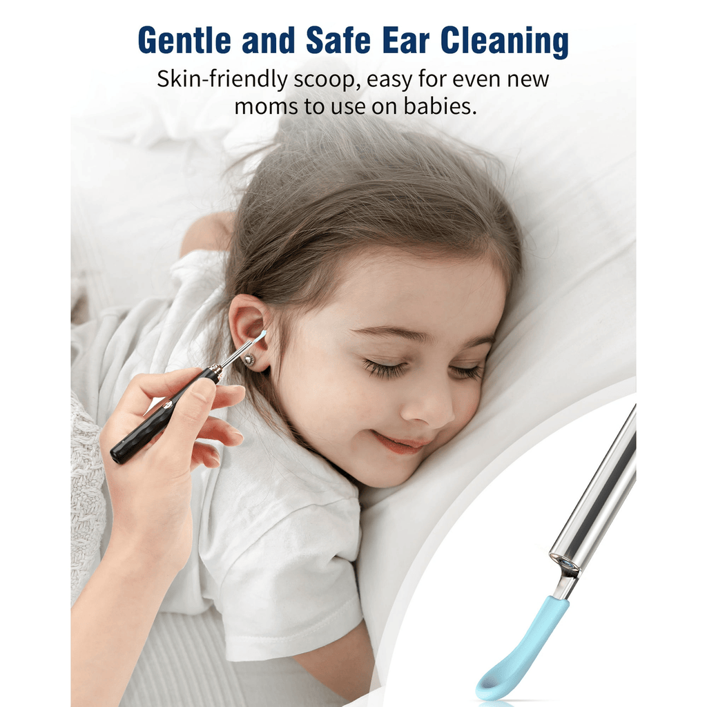 KEKOY Ear Wax Removal, Ear Cleaner, Otoscope with 1269P, Ear Camera with Light, Ear Cleaning Kit for iPhone, iPad, Android Phones, Gold