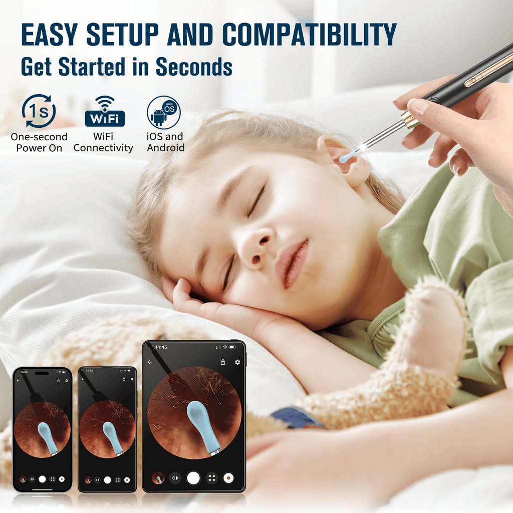 KEKOY Ear Wax Removal Kit, 1296P HD Ear Cleaner with Camera, Wifi Earwax Camera for Ear Cleaning, Wireless Otoscope for iOS & Android