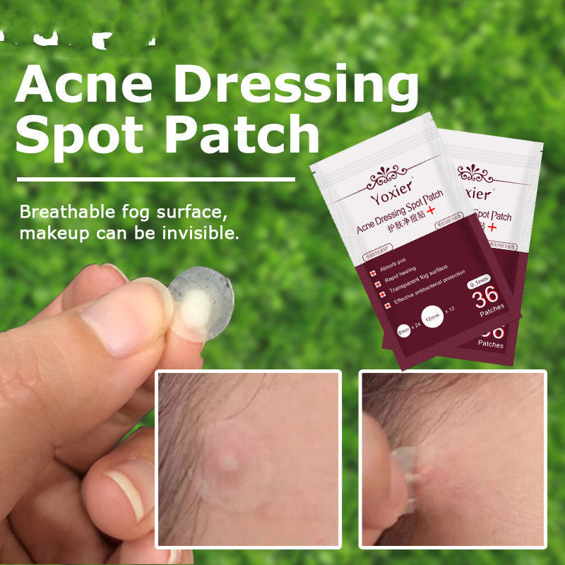 Skin Care Tools Acne Dressing Spot Patch Blemish Treatment Invisible Acne Stickers Pimple Remover Set Face Cream Lootquake LLC