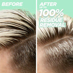 Garnier Fructis Pure Clean Hair Reset Hydrating Shampoo; Dry Scalp; 12 fl oz EasyOptionXY LLC