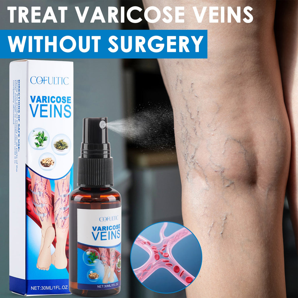 30ml Varicose Vein Spray Multi-Purpose Knee And Leg Care Spray Promote Blood Circulation Lootquake LLC