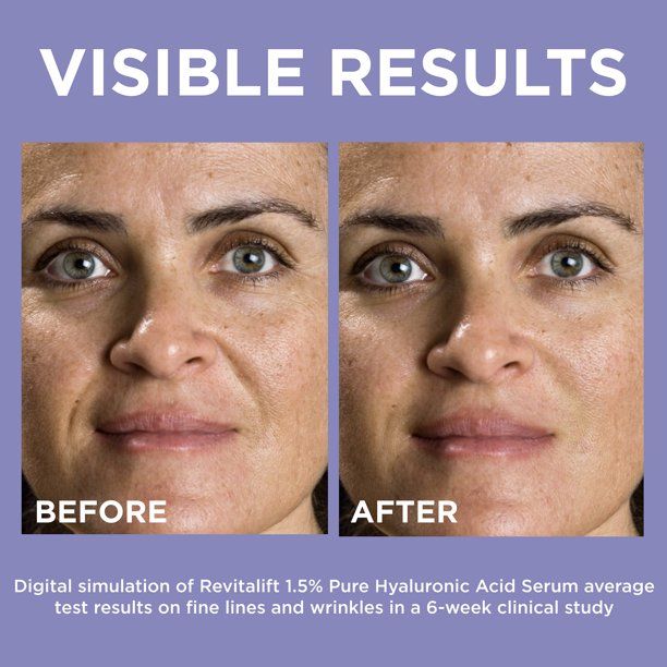 L'Oreal Paris Revitalift Derm Intensives Hyaluronic Acid Face Serum; 1 fl oz EasyOptionXY LLC