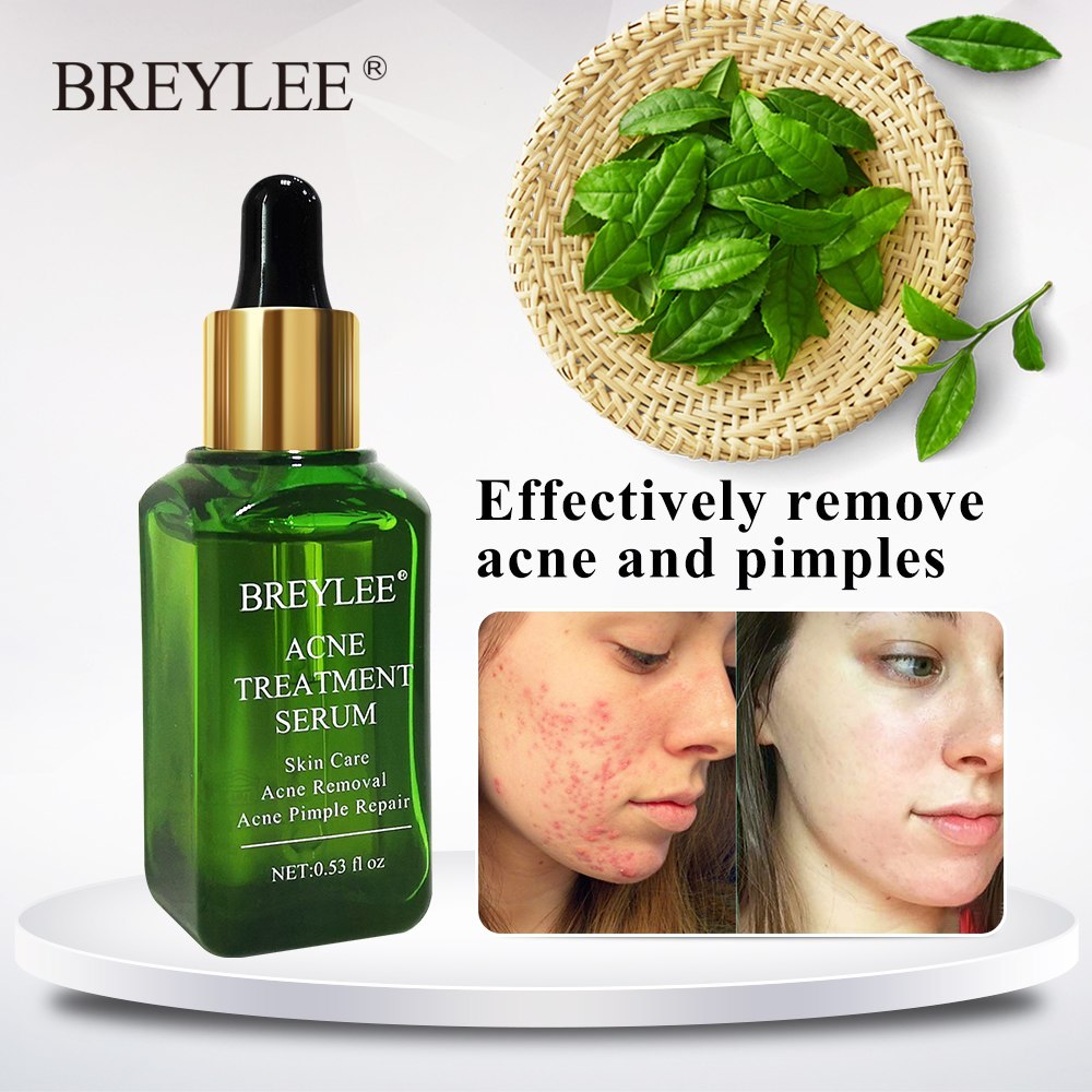 BREYLEE Acne Treatment Serum Face Facial Anti Acne Scar Removal Cream Skin Care Whitening Repair Pimple Remover For Acne Lootquake LLC