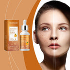 West&Month Vitamin C Brightening Serum Nourishes And Moisturizes Dull And Clear Facial Skin Lootquake LLC