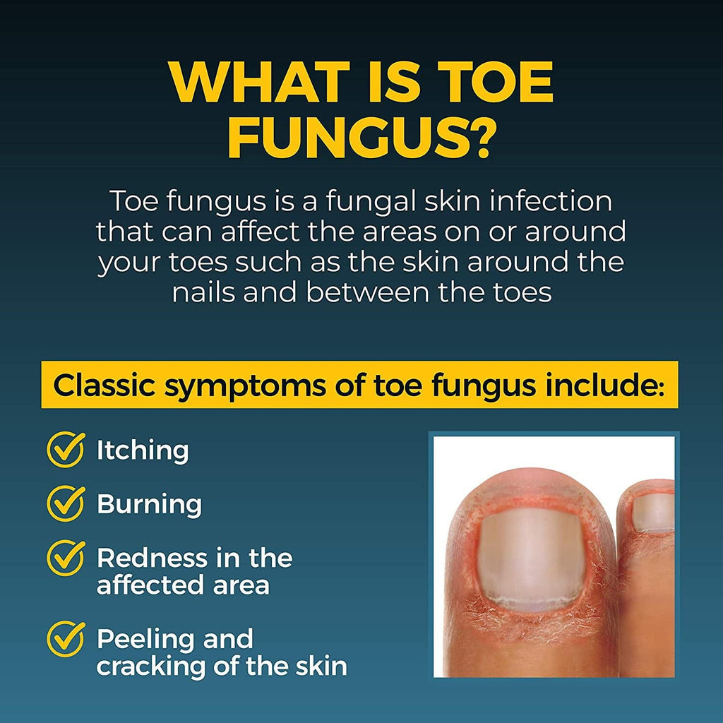 Fungi-Nail Maximum Strength Anti Fungal Pen 0.1 oz EasyOptionXY LLC