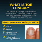 Fungi-Nail Maximum Strength Anti Fungal Pen 0.1 oz EasyOptionXY LLC