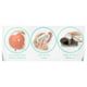 PedEgg Classic Callus Remover As Seen On TV New Look Remove Calluses & Dry Skin EasyOptionXY LLC