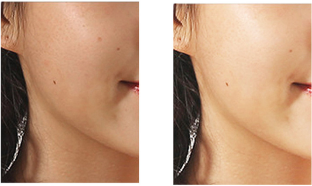 Mini Face Rotating Pore Cleansing Brush Pi-Mart