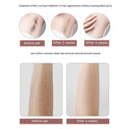 Women Hair Remover Household Men's And Women's Lady Shaver Painless Freezing Point Depilator