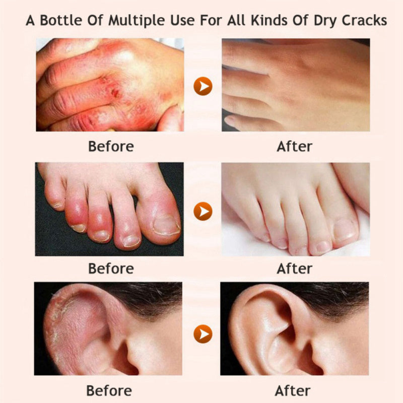 Honey moisturizing cream foot cream leg cream Lootquake LLC