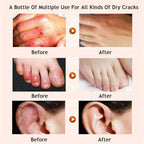 Honey moisturizing cream foot cream leg cream Lootquake LLC