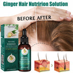 EELHOE Mature Ginger Up Hair Care Essential Oil Pi-Mart