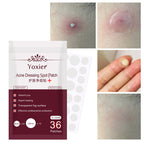 Skin Care Tools Acne Dressing Spot Patch Blemish Treatment Invisible Acne Stickers Pimple Remover Set Face Cream Lootquake LLC