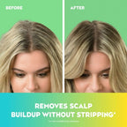 OGX Extra Strength Refreshing Scalp + Teatree Mint Nourishing Daily Shampoo, 13 fl oz EasyOptionXY LLC