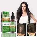 Rosemary Anti-Breakage Nourishing Hair Care Oil Lootquake LLC