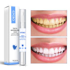 Teeth Whitening Pen Cleaning Serum Remove Plaque Stains Dental Tools Whiten Teeth Oral Hygiene Tooth Whitening Pen Lootquake LLC