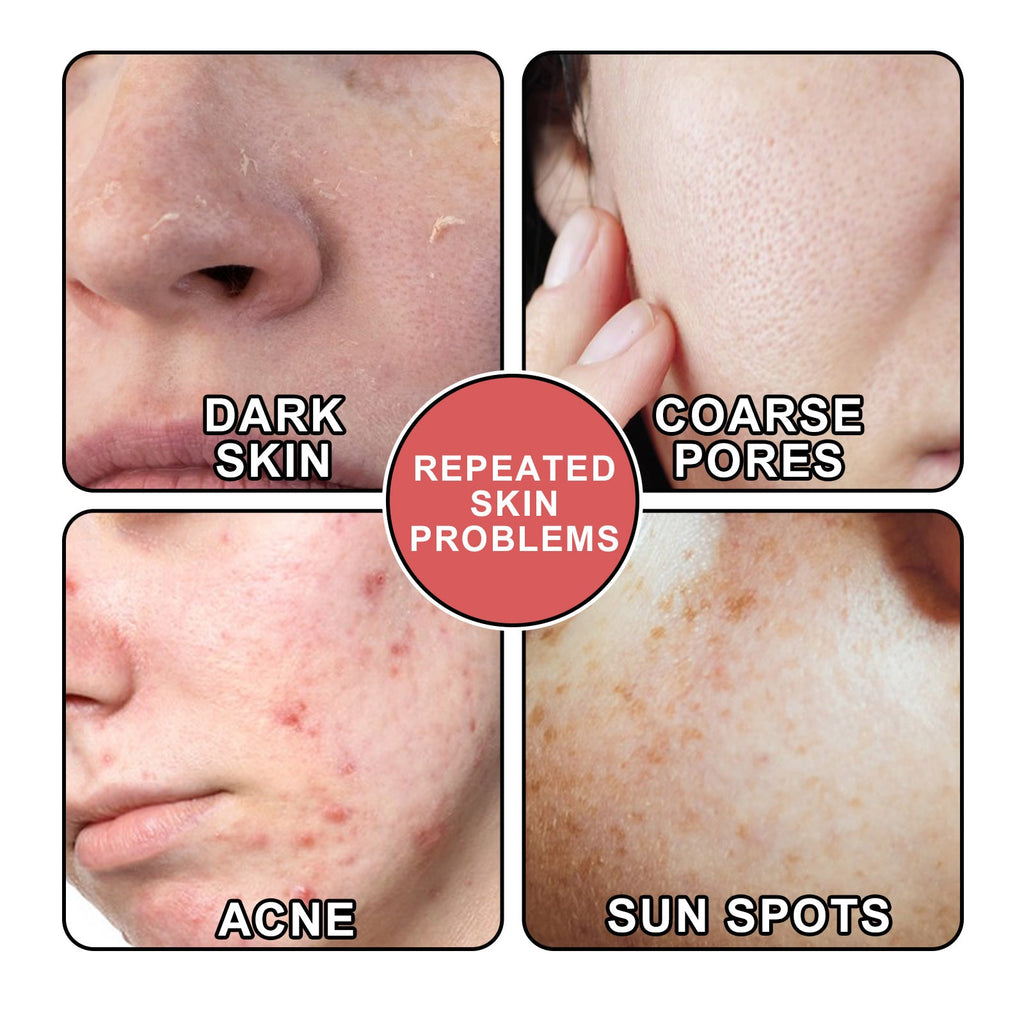 South Moon Nicotinamide Skin Care Essence Facial Skin Hydrating And Firming Skin Care Essence Lootquake LLC
