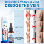 30ml Varicose Vein Spray Multi-Purpose Knee And Leg Care Spray Promote Blood Circulation Lootquake LLC