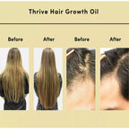 Hair Essential Oil Improve Dryness And Irritability And Nourish Lootquake LLC
