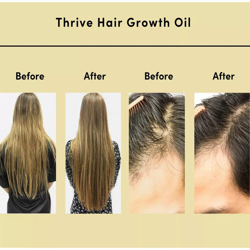 Hair Essential Oil Improve Dryness And Irritability And Nourish Lootquake LLC