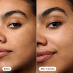 Hero Cosmetics Rescue Patch 6ct - New This is Beauty US