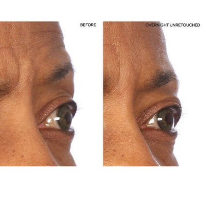SiO Beauty Super-Lift Pack Brow Eye Smile Patches - New This is Beauty US