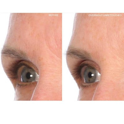SiO Beauty Brow Lift Face Mask 1ct - New This is Beauty US