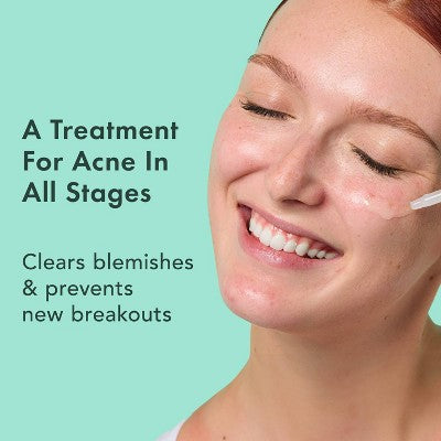 Rael Miracle Clear Complete Acne Treatment Face Serum 1oz - New This is Beauty US