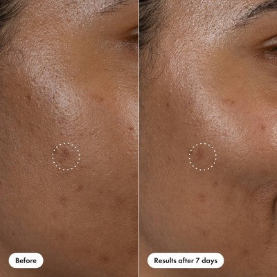 Hero Cosmetics Dark Spot Correct 10ml - New This is Beauty US