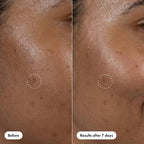 Hero Cosmetics Dark Spot Correct 10ml - New This is Beauty US