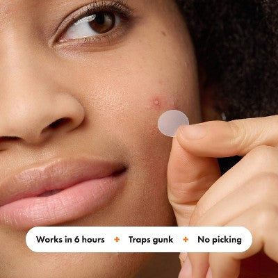Hero Cosmetics Mighty Patch Variety Acne Pimple Patches 26ct - New This is Beauty US