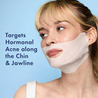 Rael Beauty Miracle Clear Retinol Chin Masks 5ct - New This is Beauty US
