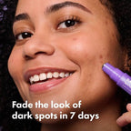 Hero Cosmetics Dark Spot Correct 10ml - New This is Beauty US