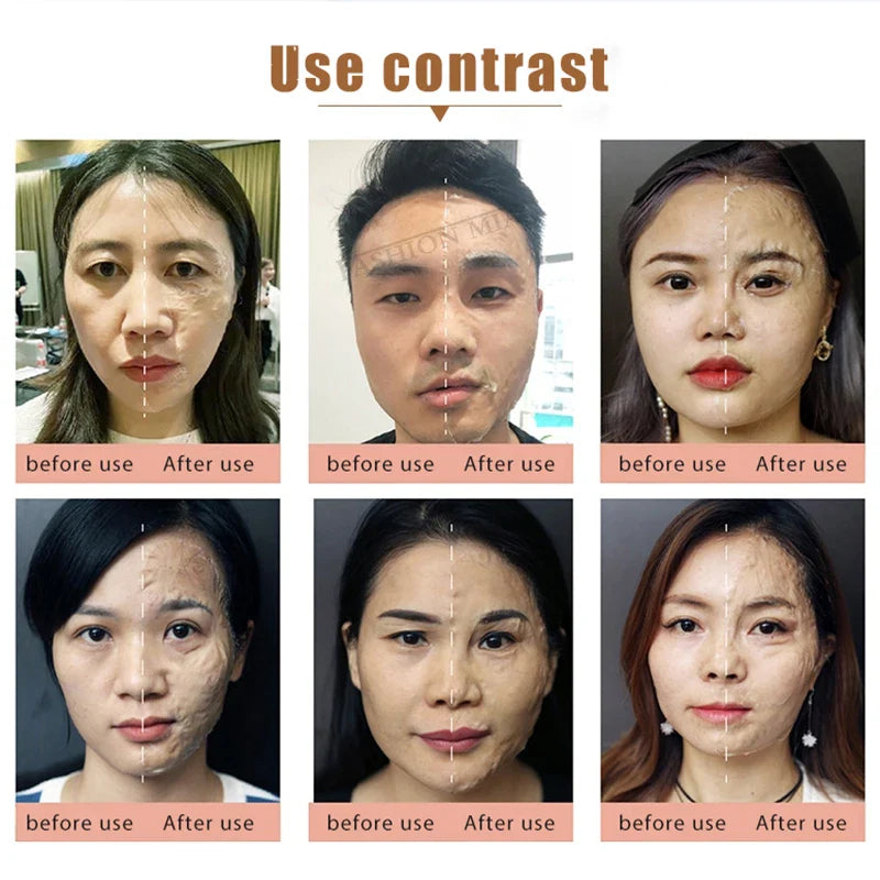 A Private Label Lifting Enzyme Mask Miracle Witch Facial Mask Face Lifting Firming V Shaping Face Sculpture Contouring Mask