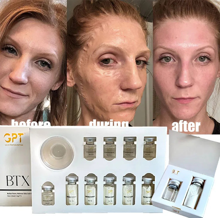 A Private Label Lifting Enzyme Mask Miracle Witch Facial Mask Face Lifting Firming V Shaping Face Sculpture Contouring Mask