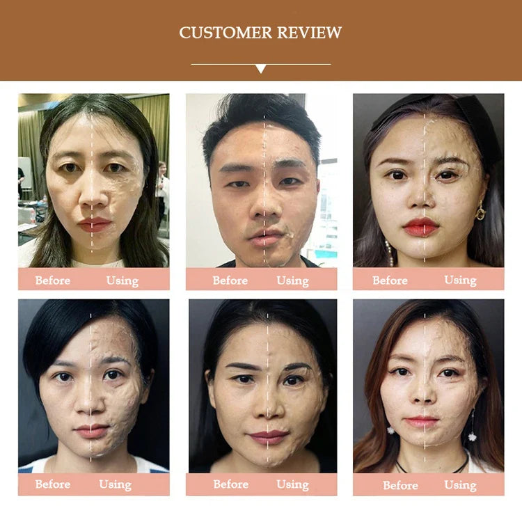 A Korea Miracle Witch Facial Mask V-Face Sculpting Lifting Firming Enzyme Mask Face V Shaping Face Sculpture Contouring Mask