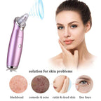 Facial Blackhead Remover Vacuum Pore Adsorber Electric Pimple Blackhead Cleaner USB Rechargeable Water Cycle Face Cleaning Tool Pi-Mart