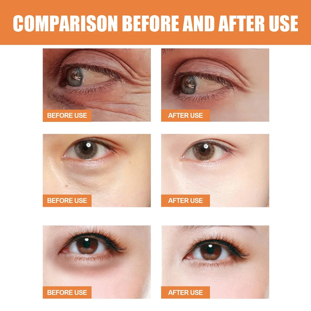 Vitamin C Eye Cream Stick Anti-Wrinkle Moisturizing Balm Eye Bag Removal Dark Circles Reduce Fine Lines Anti Puffiness Eye Cream Lootquake LLC