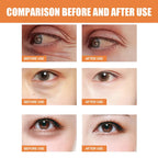 Vitamin C Eye Cream Stick Anti-Wrinkle Moisturizing Balm Eye Bag Removal Dark Circles Reduce Fine Lines Anti Puffiness Eye Cream Lootquake LLC