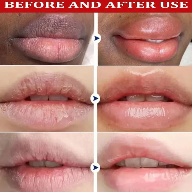 Vitamin C Remove Dark Lip Balm Lighten Melanin Lip Mask Exfoliating Fade Lip Lines Dead Skin Moisturize Brighten Repair Lip Care Lootquake LLC