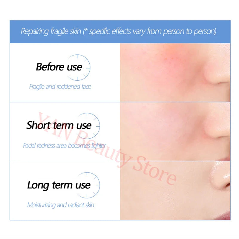 Oligopeptide Anti Wrinkle Freeze-Dried Powder Set Collagen Repairing Nourishing Firm Serum Hyaluronic Acid Moisturizing Skincare Lootquake LLC